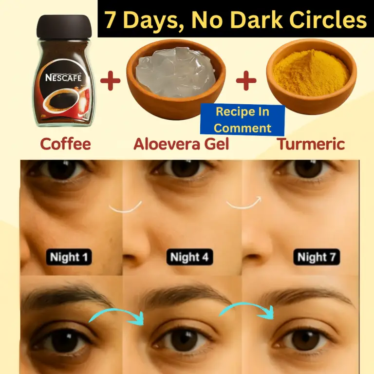 7 Days No Dark Circles: Simple Homemade Remedy Every Woman Should Try
