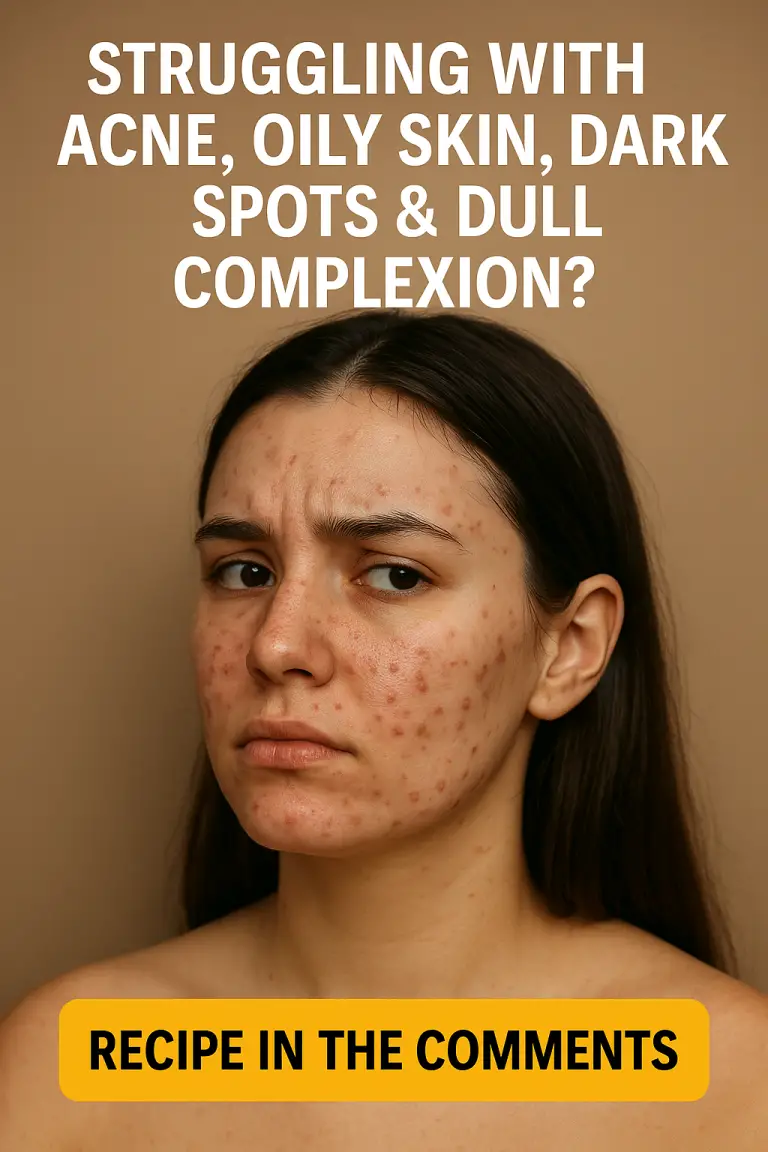 Struggling With Acne, Oily Skin, Dark Spots & Dull Complexion? Here’s a Natural Fix That Actually Works