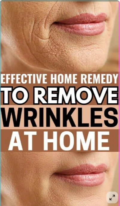 8 Natural Home Remedies To Get Rid of Wrinkles