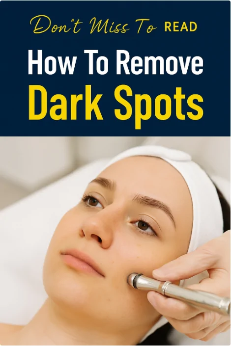 How To Remove Dark Spots: 8 Effective Remedies That Actually Work