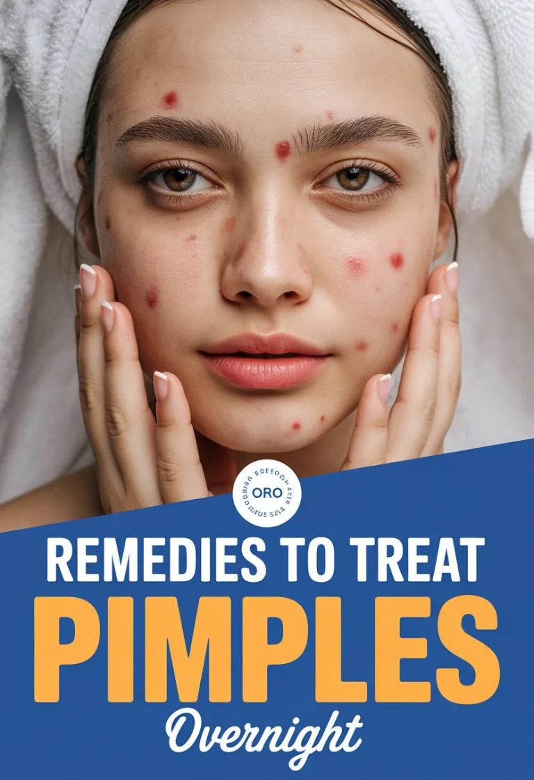 18 Remedies to Treat Pimples Overnight