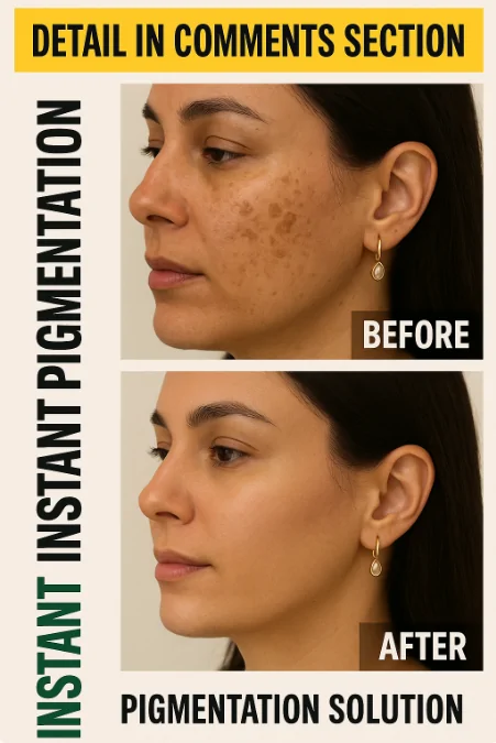 INSTANT PIGMENTATION SOLUTION – NATURAL REMEDIES BY SKIN TYPE